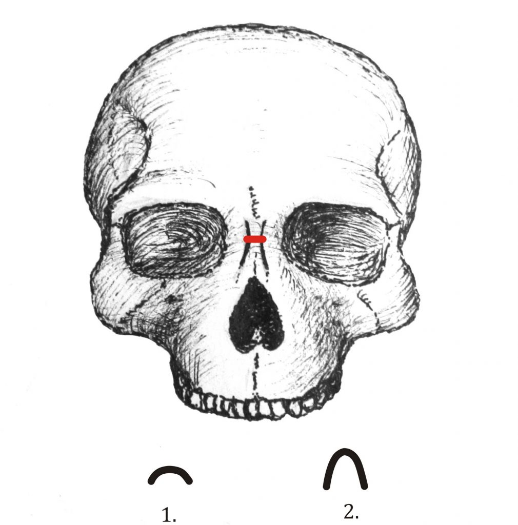 Антропология: носовые кости